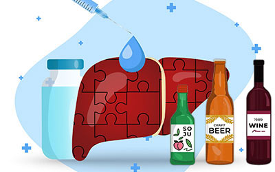 کبد چرب الکلی